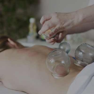 What Is Cupping? Does It Work?